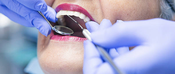 Best Emergency Dental Care for Broken or Chipped Teeth in Oak Grove, OR