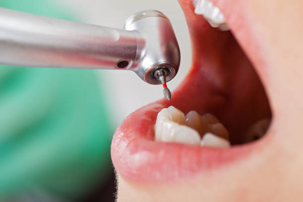 Best Cosmetic Emergency Dentistry in Oak Grove, OR